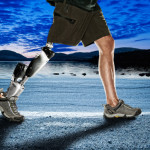 Boston Bombing Amputees  May Benefit From The Huge Advancements In Prosthetic Technology